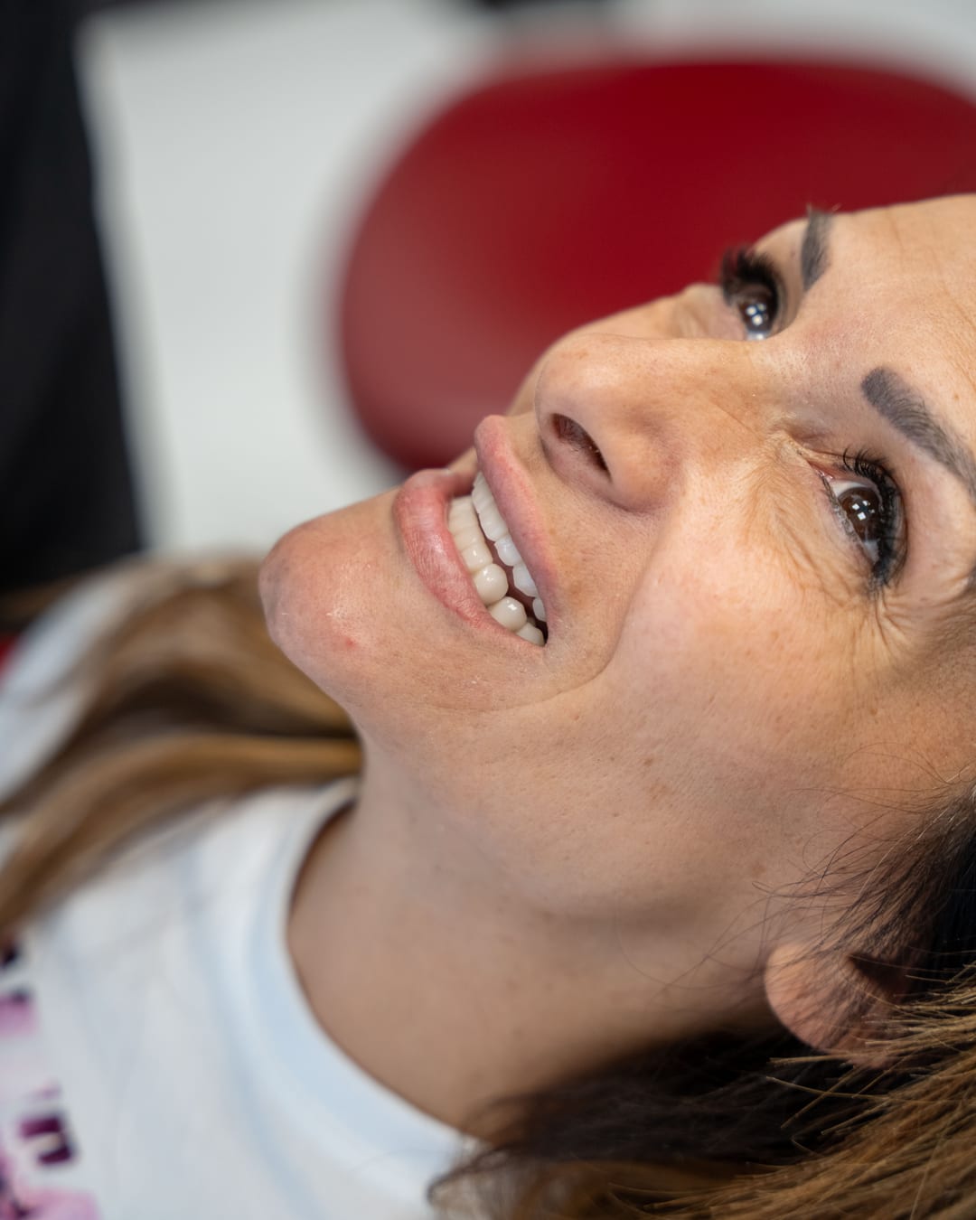 Faccette Dentali